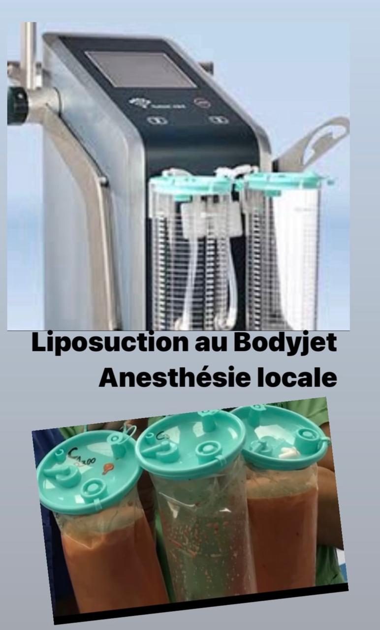 Appareil Body-Jet utilisé pour la liposuccion WAL